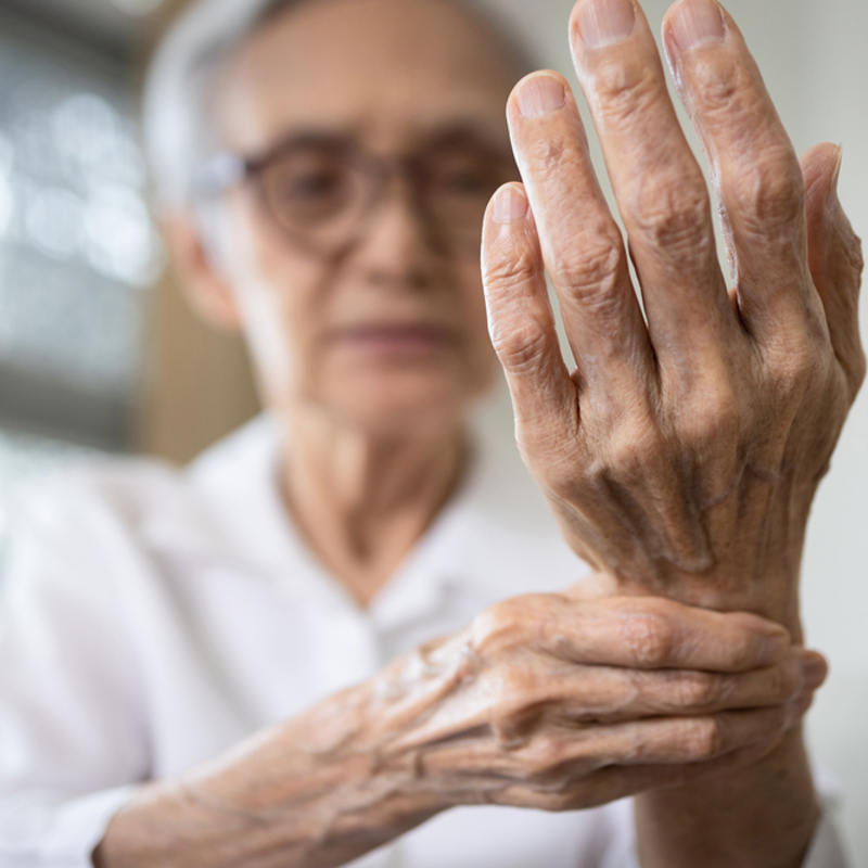An older woman with arthritis holding her wrist